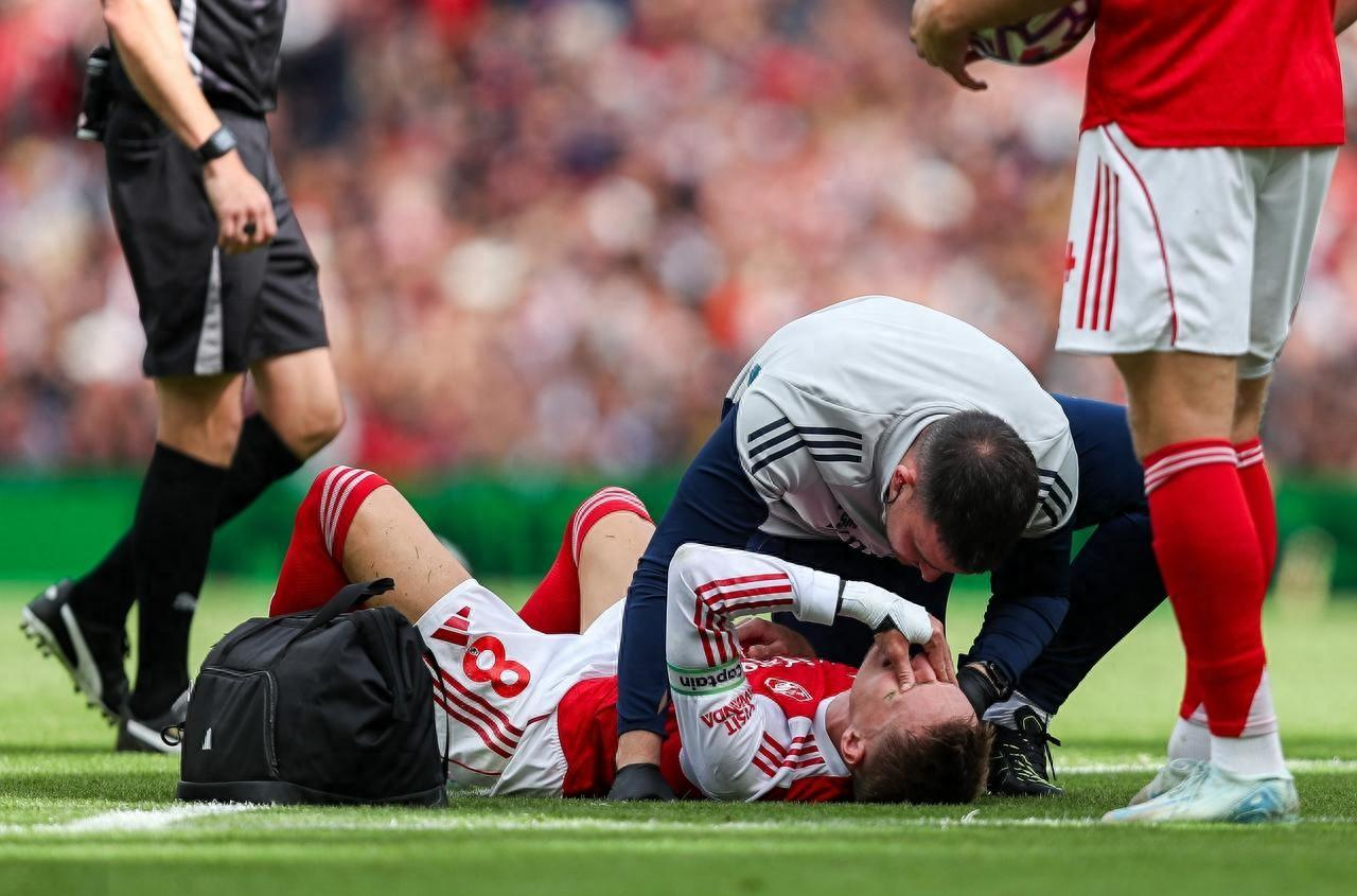 英格兰与斯洛文尼亚的比赛激烈异常，门前错失多次机会的简单介绍